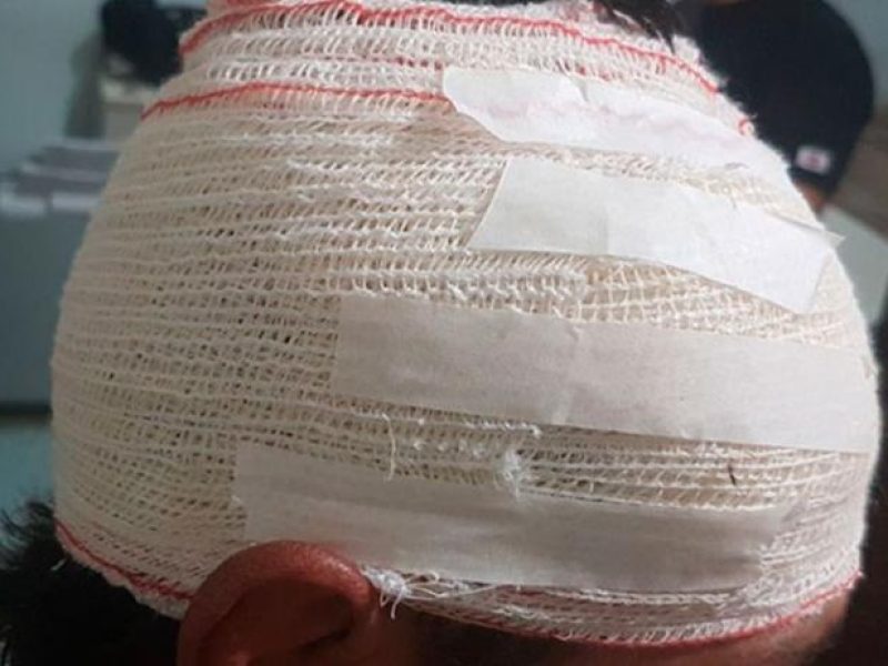 49465c395ef93bba40bc1a25343e1b32_E