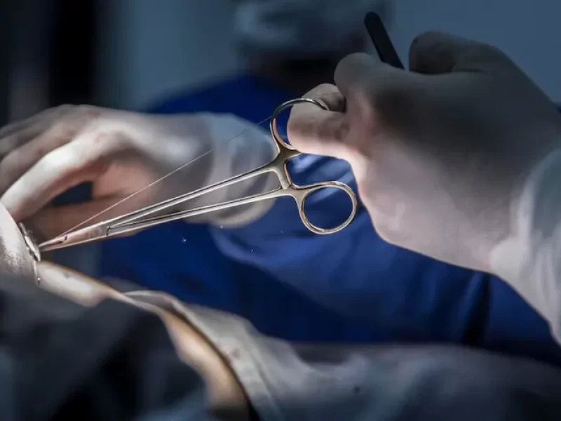 Busca-pela-beleza-relembre-cirurgias-de-celebs-que0128578100202505051041-ScaleOutside-1