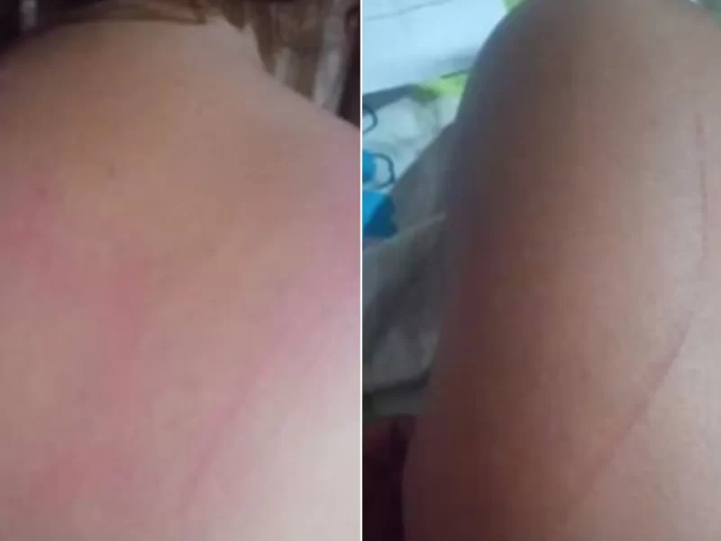 Garota-de-programa-denuncia-estupro-em-encontro-co0131161700202508190754-1