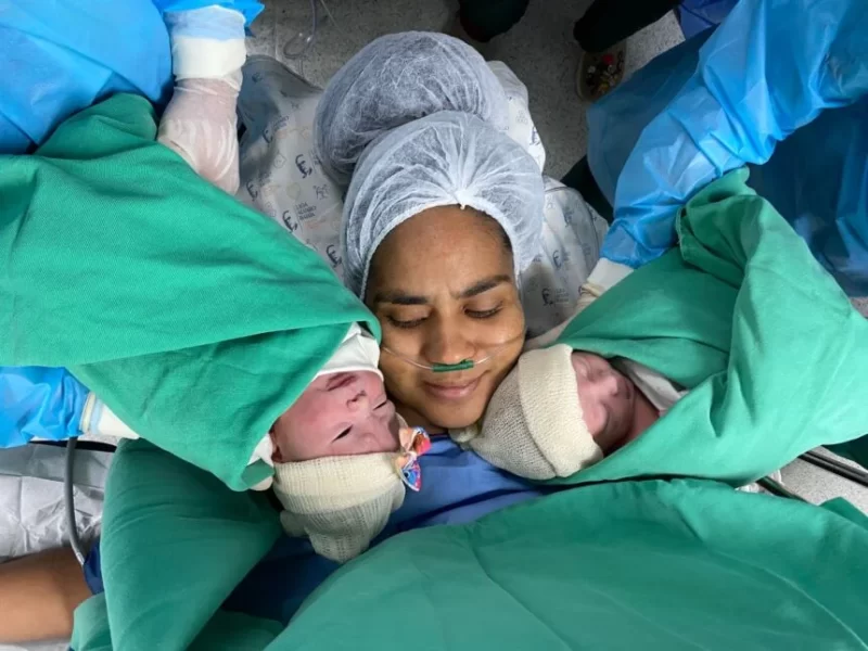 Nascimento-de-Gemelares-Maternidade-do-HEC-860x645