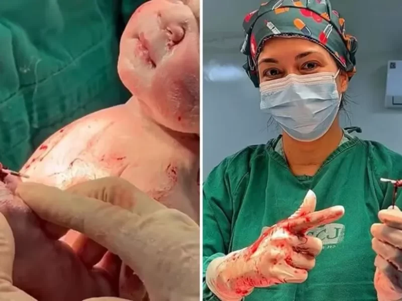 d7a812c77ff93890965e55a9366ea44e