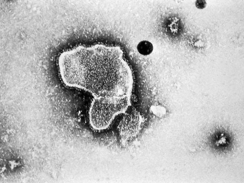 imagem-de-microscopio-do-virus-sincicial-respiratorio-vsr--2564400-article